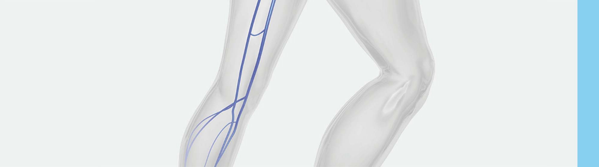 ELVeS_Illustration_bearbeitet_Strich